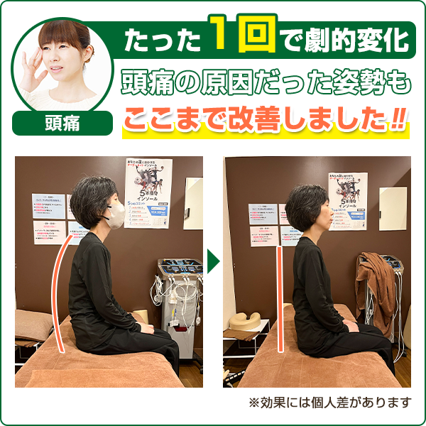 ビフォーアフター